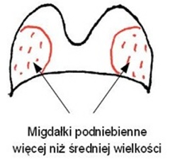 Schemat lokalizacji
migdałków podniebiennych